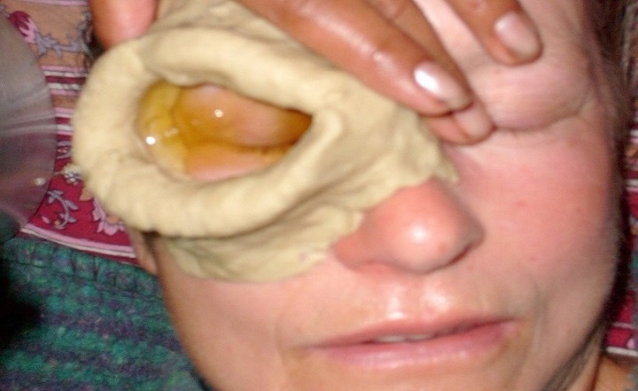 AYURVEDIC TREATMENT IN RISHIKESH